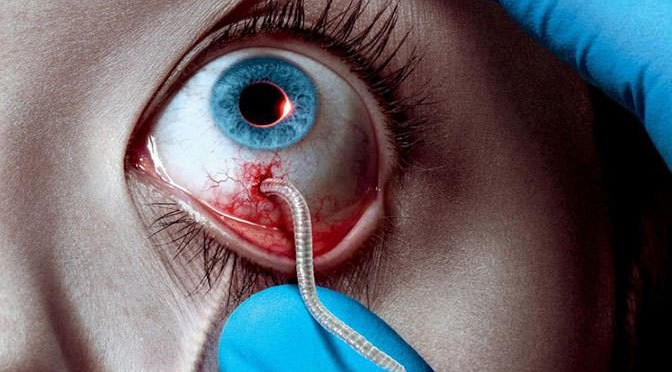 work coming out of an eye for the Strain