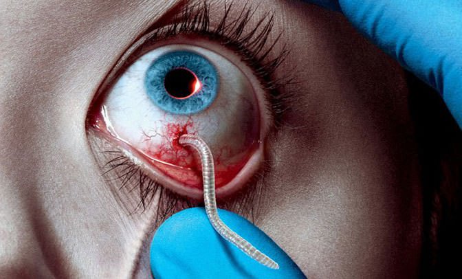 work coming out of an eye for the Strain